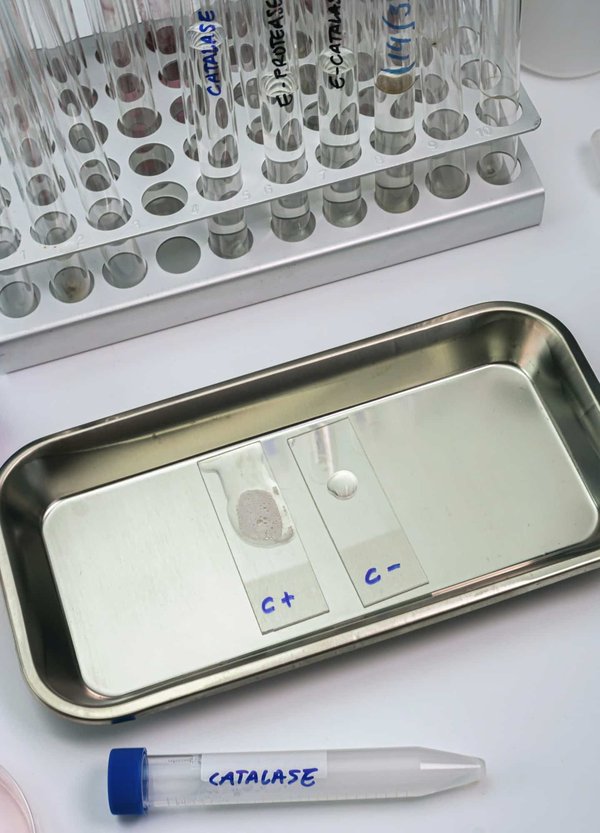 Can the Use of Digestive Enzymes Improve Gastrointestinal Function in Patients with Pancreatic Insufficiency?